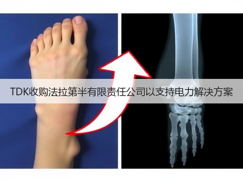 TDK收购法拉第半有限责任公司以支持电力解决方案